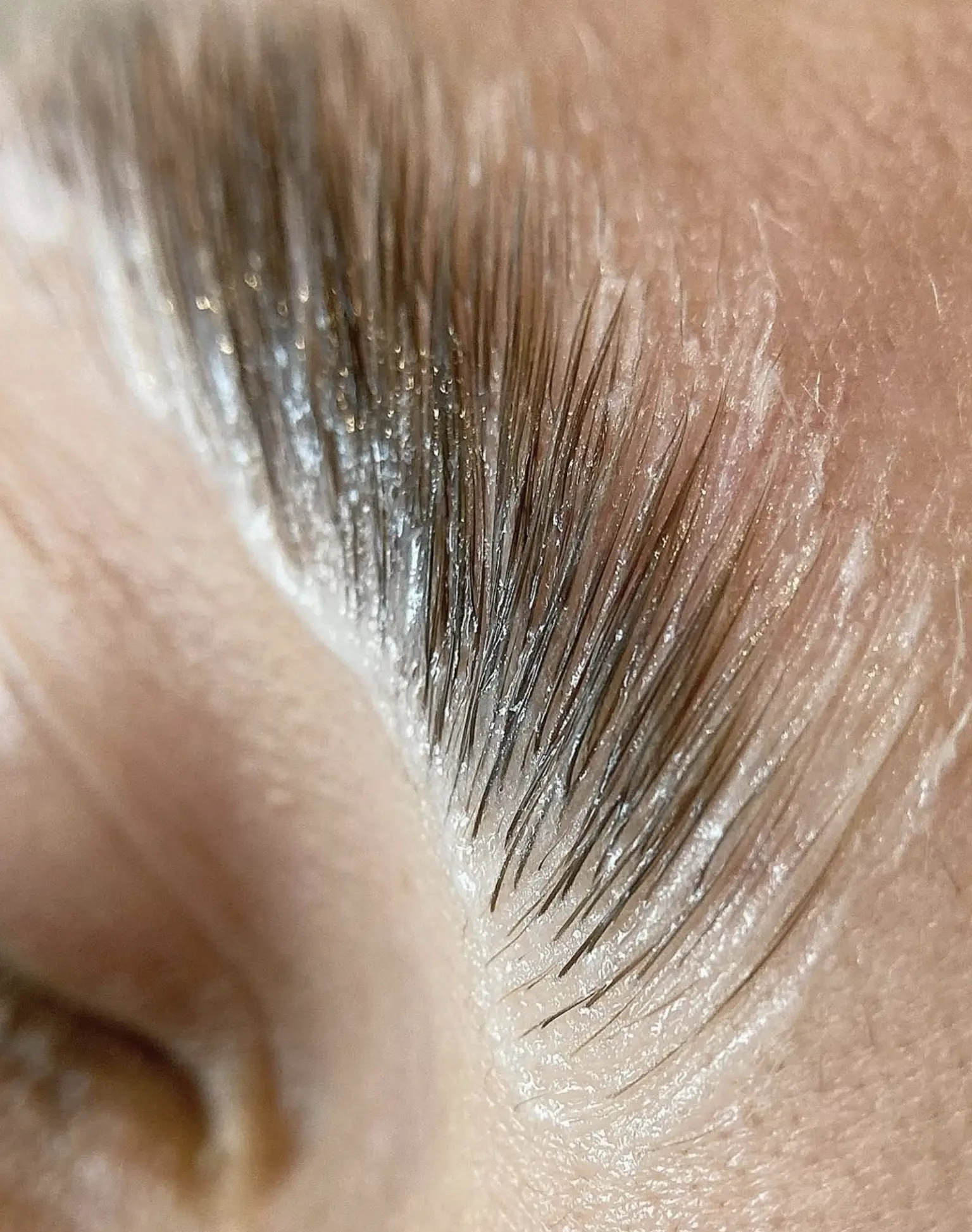 prevent ingrown hairs after waxing