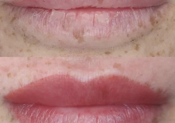What Happens to Cosmetic Tattoos as You Age?