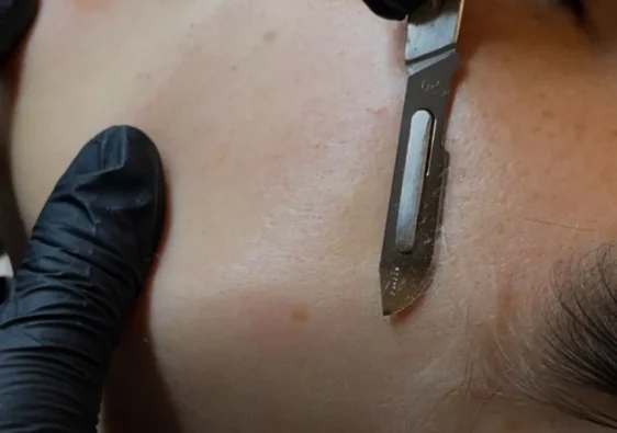 Do You Need a Certification to Perform Dermaplaning